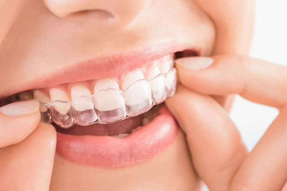 Family Dentist Brandon - Dental Theory Brandon