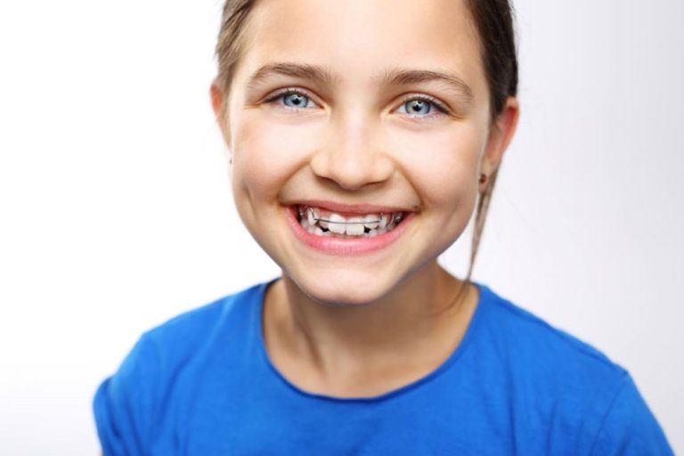 Space Maintainers Dental Theory Brandon