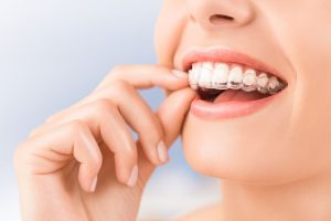 Invisalign Dentist Experts in Brandon_ Meet Dr. K and Get Started Today