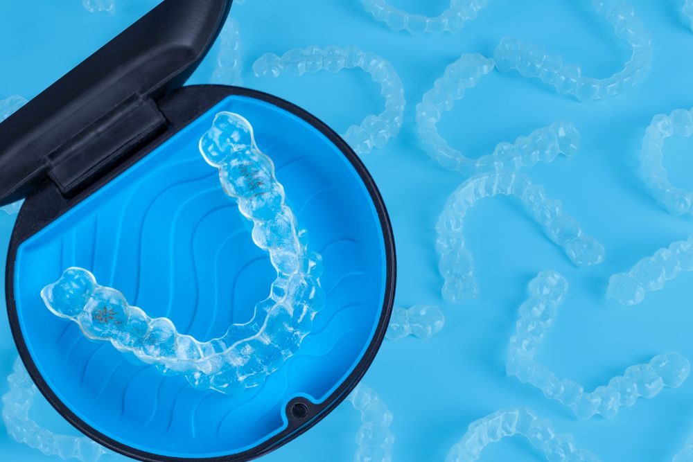 Best Rated Dentist for Invisalign Treatment at Dental Theory