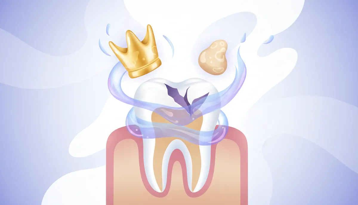 crown vs filling for broken tooth
