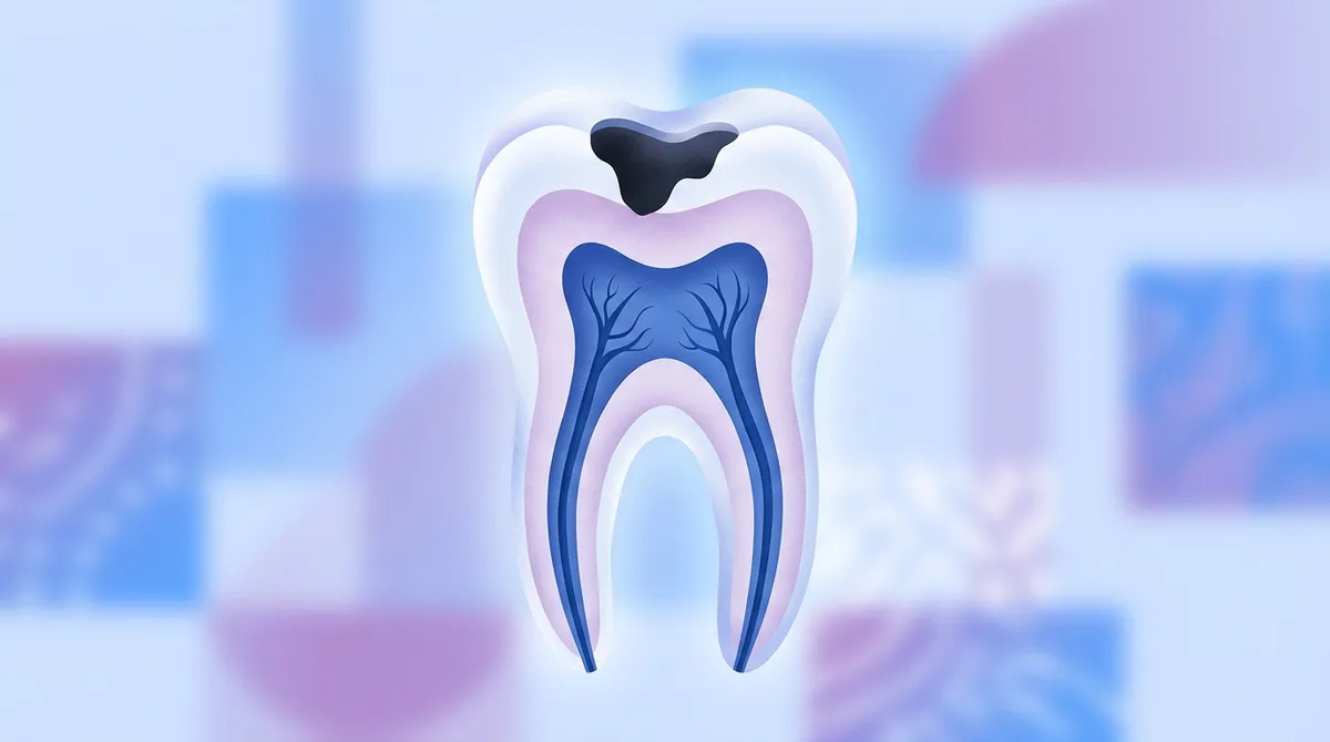 do i need a crown after root canal