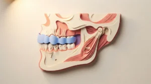 How to Tell Bruxism From a TMJ Disorder: Key Differences